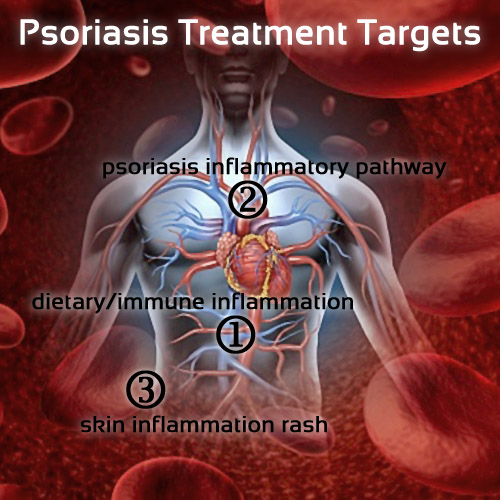 Psoriasis Treatment Targets
